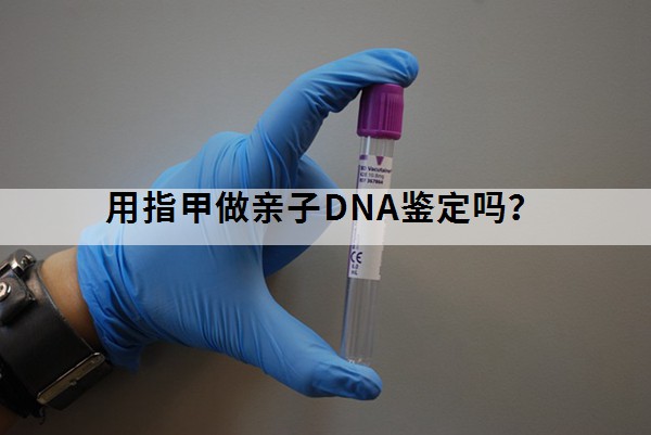用指甲做亲子DNA鉴定吗？