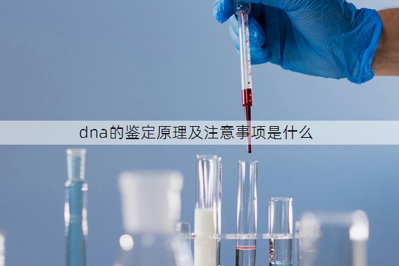 dna的鉴定原理及注意事项是什么